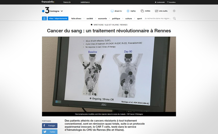 France 3 Bretagne : cancer du sang, un traitement révolutionnaire au CHU de Rennes